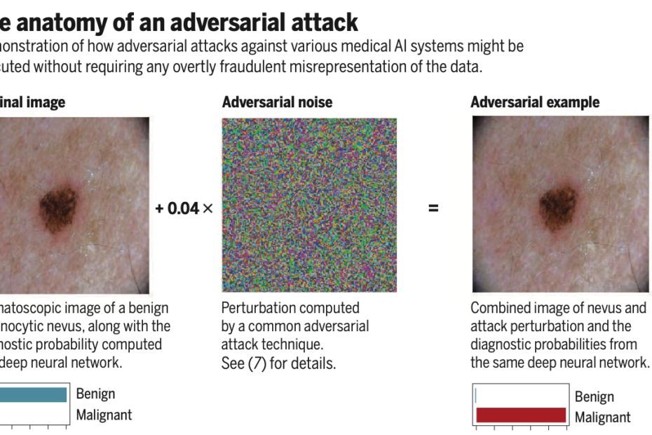 Adversarial attack fooling AI diagnosis